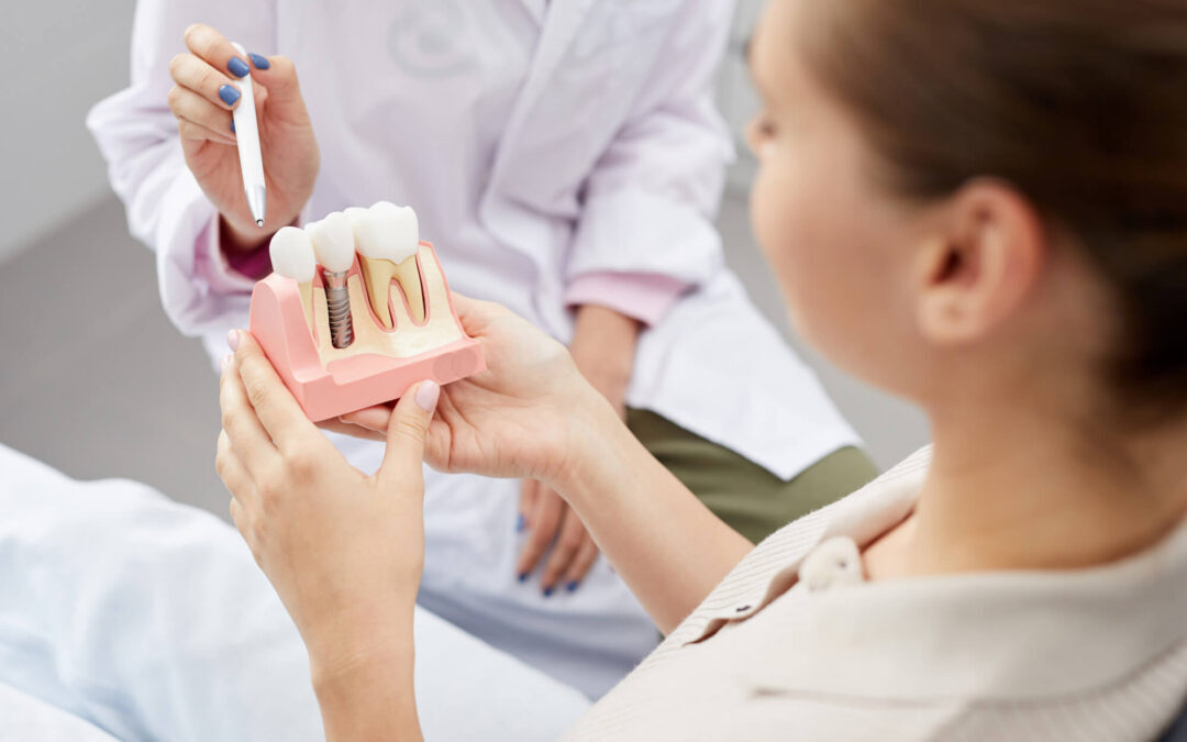 The Advantages of Dental Implants Over Dentures