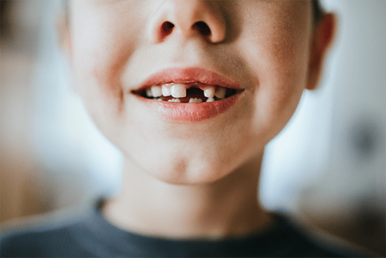 Child showing teeth
