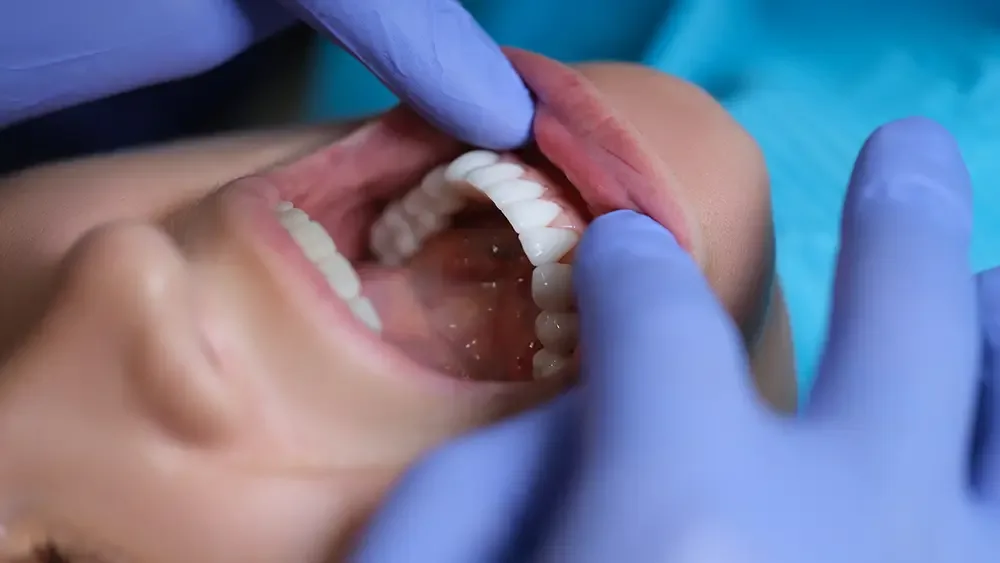 Porcelain veneers dental exam