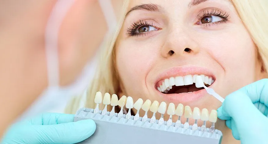 How long do veneers last?